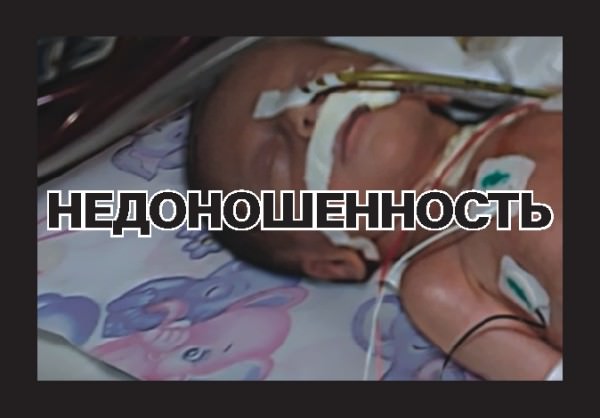 Курение вредит здоровью - Недоношенность Курение вредит здоровью - Недоношенность