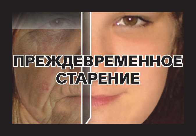 Курение вредит здоровью - Преждевременное старение Курение вредит здоровью - Преждевременное старение